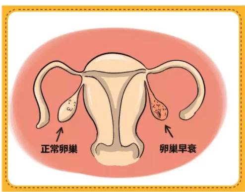 卵巢早衰的8大症状是什么？